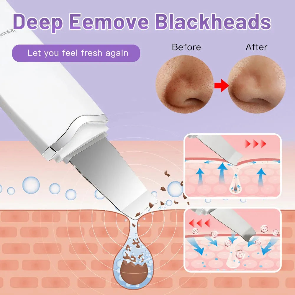 Pack Soin & Rénovation du Visage 3-en-1 – Spatule Ultrasons + Derma Roller 540 Aiguilles + Kit GuanJing (Masseur et Sérum)